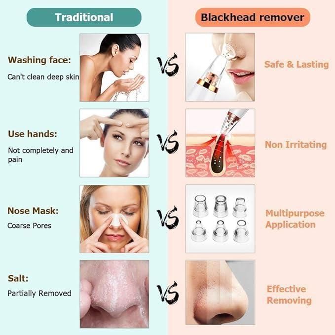 6 in 1 Multi-function Blackhead Remover